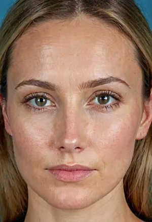 full face head and shoulders portrait of a caucasian woman aged 28-32, entire face fully visible in natural proportions, fair warm-toned skin with visible real pores on cheeks forehead and nose, natural realistic skin texture with subtle fine lines around eyes and forehead, light crow's feet at outer eye corners, slight hooding on upper eyelids with soft natural crease, almond-shaped eyes slightly downturned at outer corners, blue-green hazel iris with detailed realistic texture dark limbal ring and natural color variation, medium natural eyebrows with soft arch visible individual hairs and slight asymmetry, straight nose with rounded tip average width, full natural lips with defined cupid's bow, oval face shape high cheekbones soft jawline slightly prominent chin, long straight blonde hair with light brown roots framing the face, detailed facial anatomy realistic rendering, high resolution 8k ultra detailed, masterpiece best quality sharp focus on full face and shoulders, (full portrait composition:1.6), (entire face in frame:1.5), (photorealistic natural skin texture:1.4), (subtle fine lines and pores:1.3), (accurate eye shape blue-green color:1.4), (proportional realistic face:1.4), (no makeup:1.3)